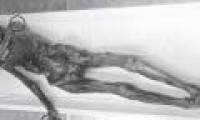 Secretly decode thousands of years of mummies