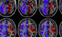 Shocking discovery about the left brain and right brain