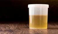 Shocking truth: Ancient Romans brushed their teeth with urine
