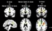 Shooting the brain may indicate the person in love