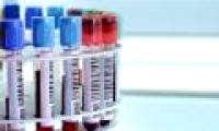 SoftBank and many other companies invest billions of money into cancer testing technology with blood