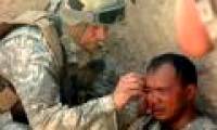 Soldiers injured in the brain are at high risk of seizures