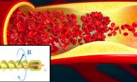 Spiral robot swims in blood vessels to break blood clots
