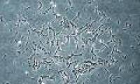 Stem cells in human bones can renew themselves