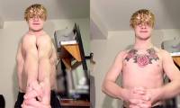 Strange disease that causes sufferers to fold their shoulders