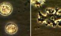Strange patients in the US have brain eating amoeba while still ... living