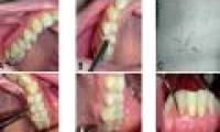 Strange woman grows hair in ... benefits
