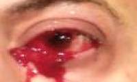 Strangely the man 'cried blood' continuously for ... 1 hour
