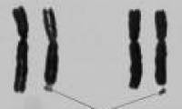 Study population by X chromosome