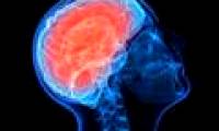 Stunned to find bacteria in the brain