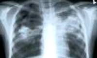 Success in preparing new vaccines for laboratories