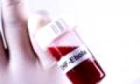 Successful development of antibodies that treat Ebola