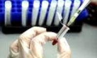 Successful preparation of vaccines against HIV