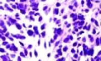 Successfully transformed stem cells into lung cells