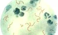 Super glue from meat-eating bacteria