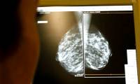 Sweden develops antibody with potential to treat cancer