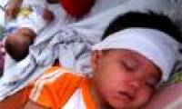 Symptoms and how to care for children with measles