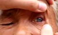 Talents help blind people see after ... 5 minutes