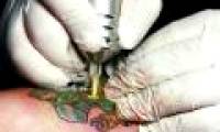 Tattoos look for skin infections