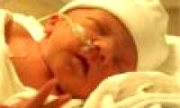 Technology for early detection of brain injury in children