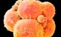 Test once know 15 thousand types of genetic diseases