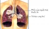 Testing for lung cancer warning in smokers