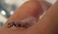The ability to heal the wound of old oxygen