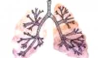 The abnormality of cancer: When the lungs turn into stomach and intestines