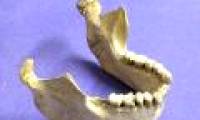 The bone fragments reveal the