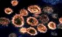 The cell adhesion capacity of SARS-CoV-2 virus is 1,000 times stronger than SARS
