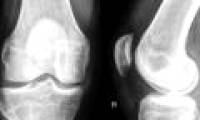 The cell technology breakthrough helps replicate parts of the human body