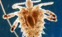 The cure for pubic lice is simple and cheap