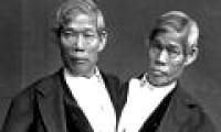 The curious life of conjoined twins 200 years ago