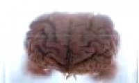 The discovery explains why people are more susceptible to neurological diseases than other species