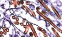 The discovery of five mutations in H5N1 determines the spread