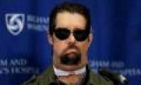 The first comprehensive face transplant in the United States to meet the press