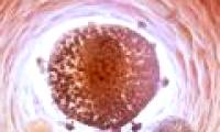 The first time to 'wipe out' the HIV virus from human cells