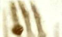 The first X-ray image made his wife invent it to be startled
