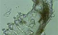 The frightening appearance of the parasite on human face