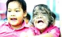 The gene mutation turns people into 'wolves'.