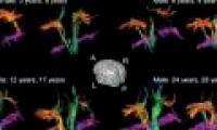 The human brain still grows as an adult?