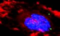 The idea of ​​'Trojan Horse' can kill cancer cells