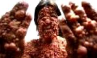 The man grows thousands of bubbles on the skin