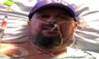 The man lost both legs because of flu complications