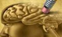 The mutant DNA code causes schizophrenia