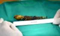 The mysterious 'alien skeleton' is decoded