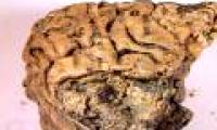 The mystery of the ancient human brain remained intact for 2,600 years without decay
