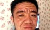 The old man wrinkled like an old man because of strange disease