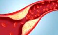 The other side of cholesterol is little known