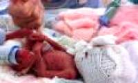 The premature baby lives on the wrong doctor